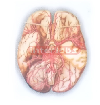 HUMAN BLOOD DISTRIBUTION MODEL OF BRAIN PITUITARY